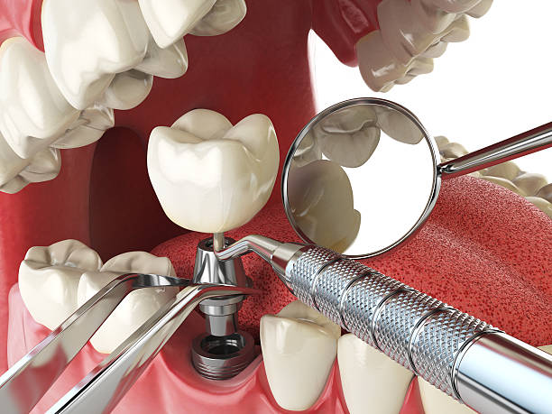 Best Weekend Emergency Dentist in New London, IA